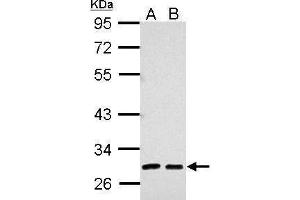 WB Image Sample (30 ug of whole cell lysate) A: 293T B: A431 10% SDS PAGE antibody diluted at 1:5000 (AMBP Antikörper)