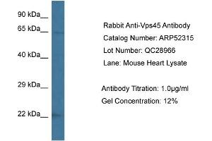 Western Blotting (WB) image for anti-Vacuolar Protein Sorting 45 (VPS45) (C-Term) antibody (ABIN2784878)