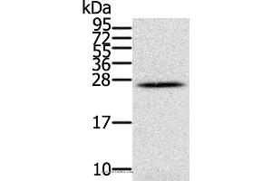 Western blot analysis of Human ovarian cancer, using IFNL3 Polyclonal Antibody at dilution of 1:350 (IL28B Antikörper)