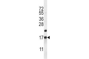 Western Blotting (WB) image for anti-CART Prepropeptide (CARTPT) antibody (ABIN2996828) (CARTPT Antikörper)