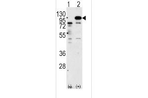 Western blot analysis of P (arrow) using rabbit polyclonal P Antibody (C-term) 6306b. (APP Antikörper  (C-Term))