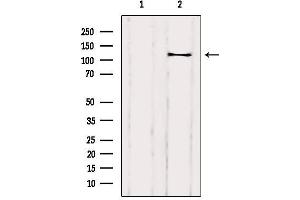 Western blot analysis of extracts from Rat heart, using DAAM1 Antibody. (DAAM1 Antikörper  (Internal Region))