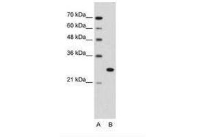 Image no. 2 for anti-Forkhead Box R2 (FOXR2) (AA 82-131) antibody (ABIN203387) (FOXR2 Antikörper  (AA 82-131))