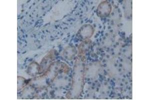 Detection of PAI2 in Rat Kidney Tissue using Monoclonal Antibody to Plasminogen Activator Inhibitor 2 (PAI2) (SERPINB2 Antikörper  (AA 154-408))