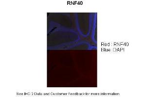 Sample Type :  Adult mouse cerebellum (l0x) section  Primary Antibody Dilution :  1:100  Secondary Antibody :  Donkey Anti-rabbit (568 nm)  Secondary Antibody Dilution :  1:500  Color/Signal Descriptions :  RNF40: Red DAPI:Blue  Gene Name :  RNF40  Submitted by :  Anonymous (RNF40 Antikörper  (C-Term))