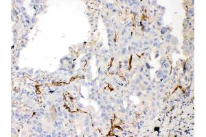 IHC analysis of Bcl-XL using anti-Bcl-XL antibody . (BCL2L1 Antikörper  (AA 1-219))