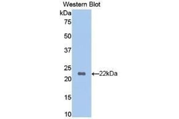 Hemoglobin Subunit beta Antikörper  (AA 1-147)