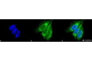 Immunocytochemistry/Immunofluorescence analysis using Rabbit Anti-KDEL Polyclonal Antibody . (KDEL Antikörper  (Atto 488))