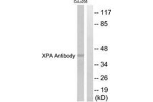 Western blot analysis of extracts from COLO205 cells, using XPA Antibody. (PA (AA 211-260) Antikörper)