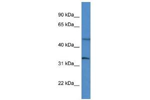 WB Suggested Anti-Foxl2 Antibody Titration:  0. (FOXL2 Antikörper  (Middle Region))