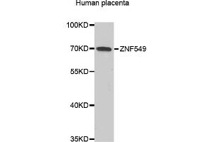 Western blot analysis of extracts of Human placenta, using ZNF549 antibody (ABIN6293799) at 1:1000 dilution. (ZNF549 Antikörper)