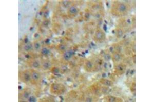 IHC-P analysis of Liver tissue, with DAB staining. (OLR1 Antikörper  (AA 60-312))