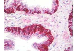 Anti-NCBP1 / CBP80 antibody IHC staining of human prostate. (NCBP1 Antikörper  (Internal Region))