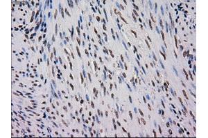 Immunohistochemical staining of paraffin-embedded Carcinoma of kidney tissue using anti-MRI1mouse monoclonal antibody. (MRI1 Antikörper)