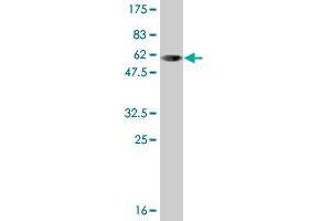 Western Blotting (WB) image for anti-Sulfotransferase Family, Cytosolic, 1A, Phenol-Preferring, Member 1 (SULT1A1) (AA 1-295) antibody (ABIN520604)