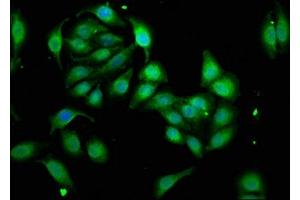 Immunofluorescence staining of A549 cells with ABIN7175838 at 1:33, counter-stained with DAPI. (WASF3 Antikörper  (AA 368-502))