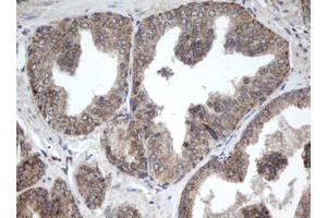 Image no. 1 for anti-Palmitoyl-Protein Thioesterase 1 (PPT1) (AA 100-306) antibody (ABIN1490801) (PPT1 Antikörper  (AA 100-306))