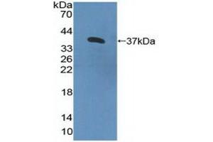 Detection of Recombinant IL8Rb, Human using Polyclonal Antibody to Interleukin 8 Receptor Beta (IL8Rb) (CXCR2 Antikörper  (AA 1-57))