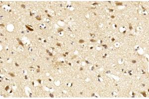 Immunohistochemical analysis of paraffin-embedded Human brain section using LINGO-1(LRRN6A)- (C-term) Antibody (ABIN651289 and ABIN2840172). (LINGO1 Antikörper  (C-Term))