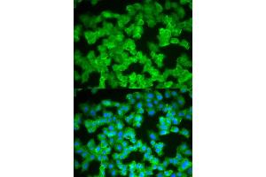 Immunofluorescence (IF) image for anti-S100 Calcium Binding Protein A12 (S100A12) antibody (ABIN1876516) (S100A12 Antikörper)