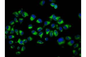 Immunofluorescence staining of Hela cells with ABIN7149086 at 1:200, counter-stained with DAPI. (Cytochrome B Reductase 1 Antikörper  (AA 220-286))