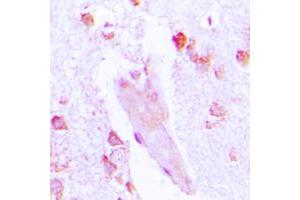 Immunohistochemical analysis of Carbonic Anhydrase 1 staining in human brain formalin fixed paraffin embedded tissue section. (CA1 Antikörper  (Center))