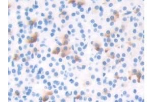 DAB staining on IHC-P; Samples: Rat Adrenal gland Tissue (TBX3 Antikörper  (AA 107-220))