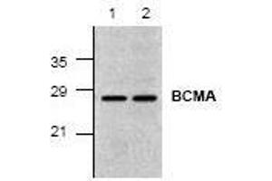 Image no. 1 for anti-Tumor Necrosis Factor Receptor Superfamily, Member 17 (TNFRSF17) (C-Term) antibody (ABIN127204) (BCMA Antikörper  (C-Term))