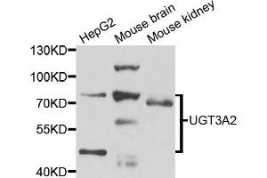 Western blot analysis of extracts of various cell lines, using μgT3A2 antibody (ABIN5975308) at 1/1000 dilution. (UGT3A2 Antikörper)
