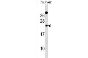 Western Blotting (WB) image for anti-Der1-Like Domain Family, Member 2 (DERL2) antibody (ABIN3000861) (Der1-Like Domain Family, Member 2 (DERL2) Antikörper)