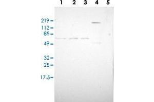 Western blot analysis of Lane 1: RT-4, Lane 2: U-251 MG, Lane 3: A-431, Lane 4: Liver, Lane 5: Tonsil with ZBTB16 polyclonal antibody  at 1:100-1:250 dilution. (ZBTB16 Antikörper)