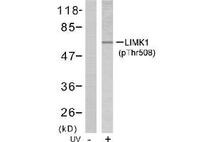 Image no. 2 for anti-LIM Domain Kinase 1 (LIMK1) (pThr508) antibody (ABIN196831) (LIM Domain Kinase 1 Antikörper  (pThr508))