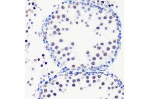 Immunohistochemistry of paraffin-embedded mouse testis using MonoMethyl-Histone H3-R8 antibody (ABIN3017482, ABIN3017483, ABIN3017484 and ABIN6220107) at dilution of 1:100 (40x lens).