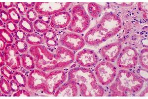 Human Kidney: Formalin-Fixed, Paraffin-Embedded (FFPE) (APOA2 Antikörper)