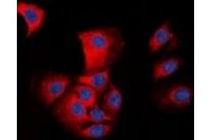 Immunofluorescent analysis of ASC staining in HepG2 cells. (STS Antikörper  (N-Term))