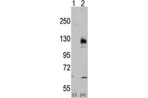 Western blot analysis of TRPM8 antibody and 293 cell lysate either nontransfected (Lane 1) or transiently transfected with the TRPM8 gene (2). (TRPM8 Antikörper  (AA 926-956))