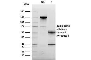 SDS-PAGE Analysis Purified Endoglin / CD105 Mouse Monoclonal Antibody (ENG/3269). (Endoglin Antikörper  (AA 74-251))