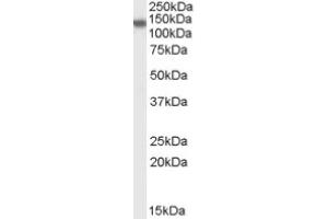 Image no. 1 for anti-PH Domain and Leucine Rich Repeat Protein Phosphatase 2 (PHLPP2) (C-Term) antibody (ABIN374772) (PHLPP2 Antikörper  (C-Term))