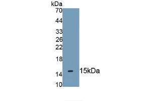 Detection of Recombinant KRT2, Human using Monoclonal Antibody to Keratin 2 (CK2) (Keratin 2 Antikörper  (AA 7-160))