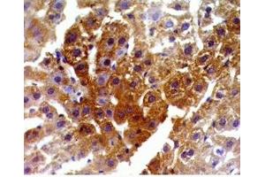 Immunohistochemistry (IHC) image for anti-Nuclear Receptor Subfamily 1, Group H, Member 4 (NR1H4) (AA 446-476) antibody (ABIN2872215)