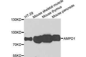 Western blot analysis of extracts of various cell lines, using AMPD1 antibody (ABIN5995393) at 1/1000 dilution. (AMPD1 Antikörper)