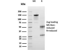 SDS-PAGE Analysis Purified ICOS-L Mouse Monoclonal Antibody (ICOSL/3260). (ICOSLG Antikörper  (AA 23-149))