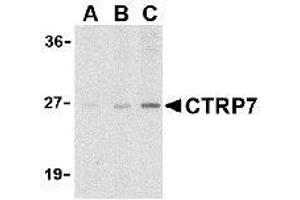 Western blot analysis of CTRP7 in 3T3 cell lysate with AP30259PU-N CTRP7 antibody at (A) 1, (B) 2, and (C) 4 μg/ml. (CTRP7 Antikörper  (N-Term))