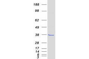 Western Blotting (WB) image for Fructosamine 3 Kinase (FN3K) protein (Myc-DYKDDDDK Tag) (ABIN2721423)