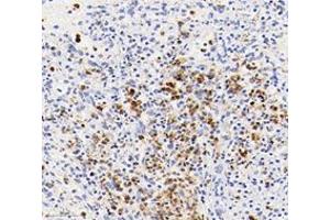 Immunohistochemistry analysis of paraffin-embedded human spleen using,S100A12 (ABIN7075493) at dilution of 1: 4000 (S100A12 Antikörper)