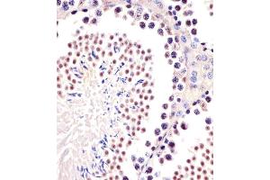 (ABIN6244019 and ABIN6577664) staining (Mouse) Trim24 in mouse testis sections by Immunohistochemistry (IHC-P - paraformaldehyde-fixed, paraffin-embedded sections). (TRIM24 Antikörper  (C-Term))