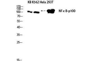 Western Blot (WB) analysis of KB K562 HeLa 293T lysis using NFkappaB-p100 antibody. (NFKB2 Antikörper  (Thr160))