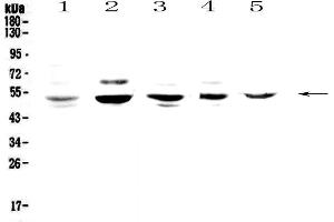 Western blot analysis of NFIB/NF1B2 using anti-NFIB/NF1B2 antibody .