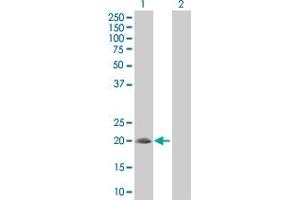 Western Blot analysis of SNX24 expression in transfected 293T cell line by SNX24 MaxPab polyclonal antibody.
