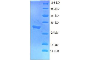 SDS-PAGE (SDS) image for Interferon-Induced Transmembrane Protein 1 (IFITM1) (AA 1-36) protein (GST tag) (ABIN7479270)